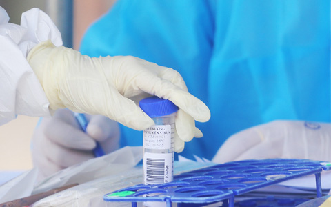 Tin COVID hôm nay tối 174 Số mắc COVID19 giảm xuống thấp nhất trong hơn 2 tháng còn 14660 ca